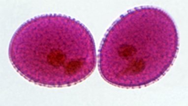dois grãos de pólen visualizados em ultramicroscópio. Do lírio.